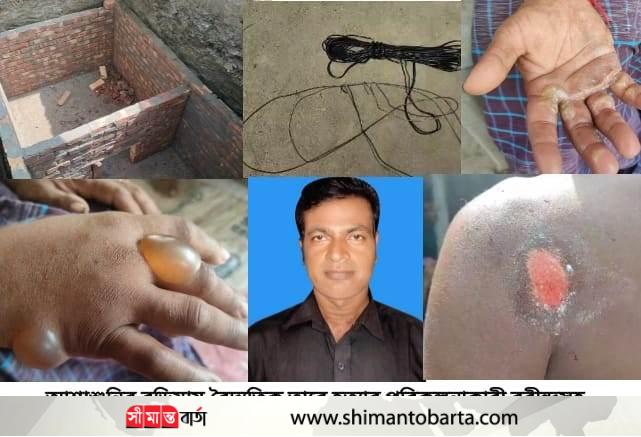 আশাশুনিতে কুপ্রস্তাবে রাজি না হওয়ায় স্বামীকে বৈদ্যুতিক তার দিয়ে হত্যা চেষ্টা