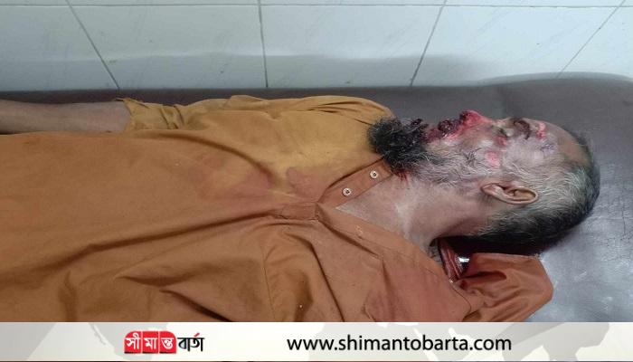 আশাশুনিতে সড়ক দুর্ঘটনায় নিহত-১