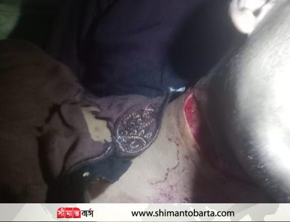 নলতায় এক কিশোরকে জবাই করে হত্যা চেষ্টা